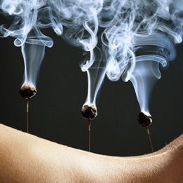 Moxibustion en Málaga